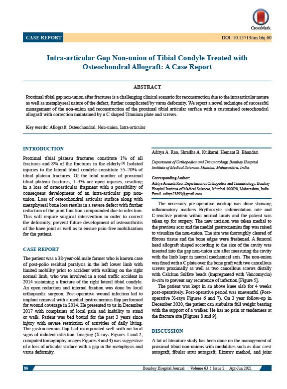 Intra-articular Gap Non-union of Tibial Condyle Treated with
