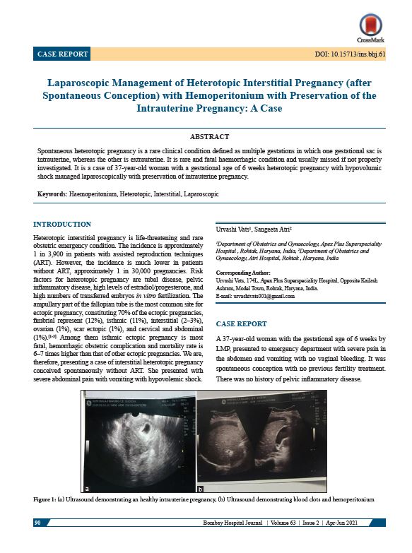 Laparoscopic Management of Heterotopic Interstitial Pregnancy