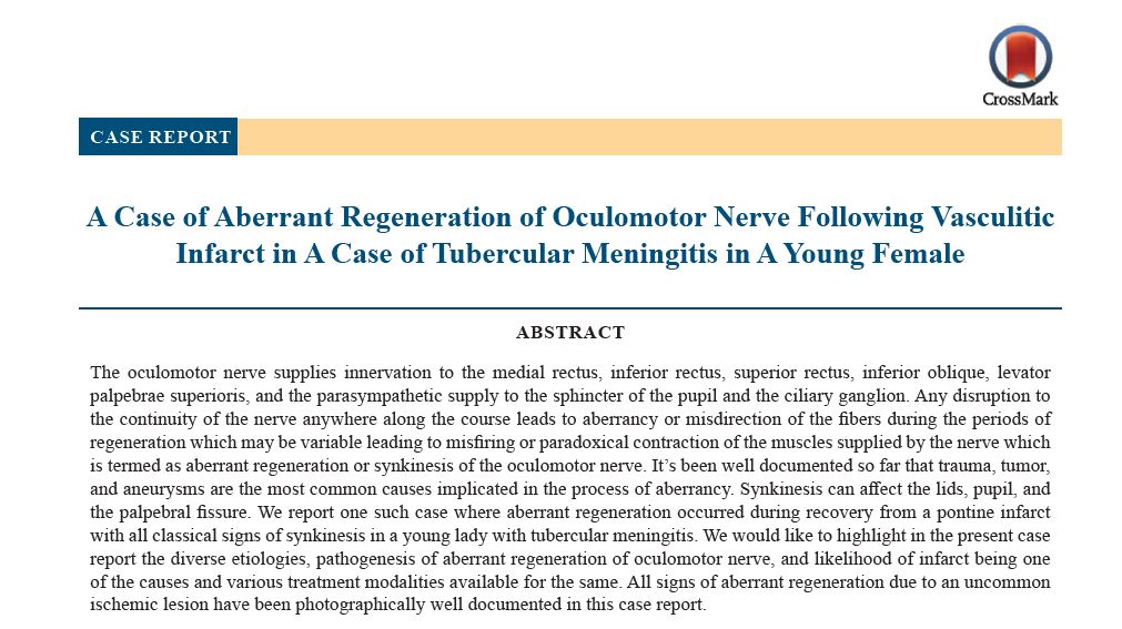 A Case of Aberrant Regeneration of Oculomotor Nerve Following Vasculitic<br>Infarct in A Case of Tubercular Meningitis in A Young Female