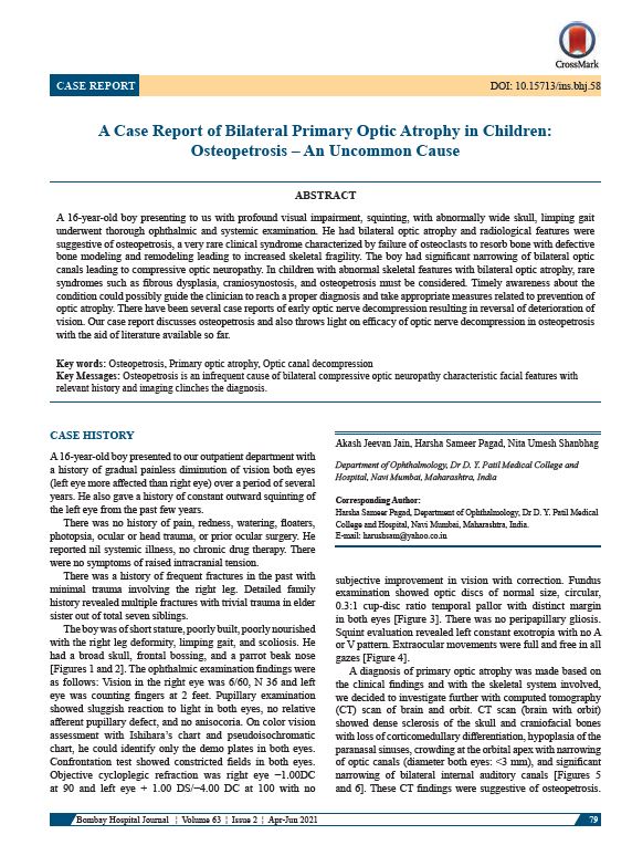 A Case Report of Bilateral Primary Optic Atrophy in Children